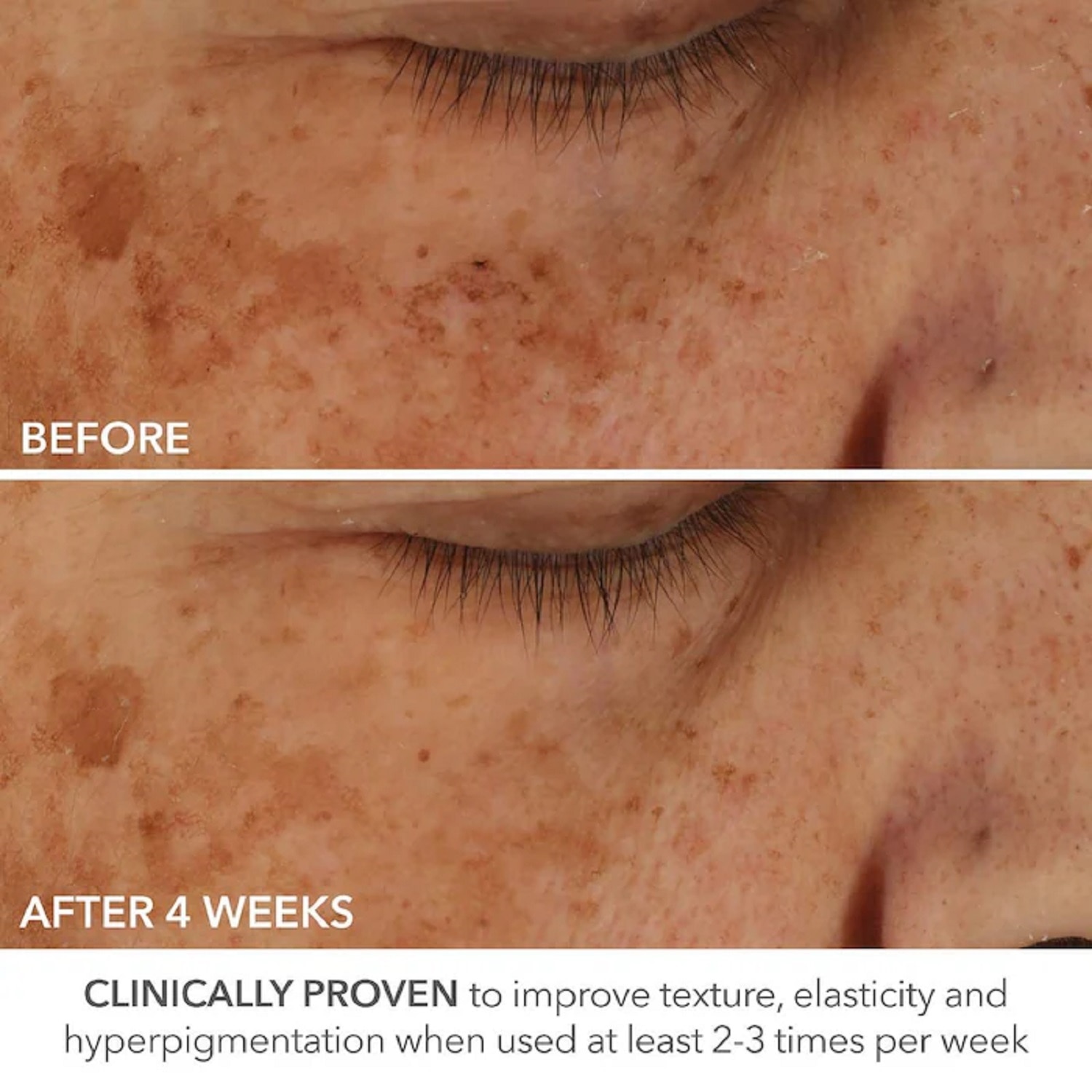 ADVANCED RETINOL + FERULIC PERFECTLY DOSED RETINOL UNIVERSAL 0.2% (ALMOHADILLAS EXFOLIANTES CON RETINOL)